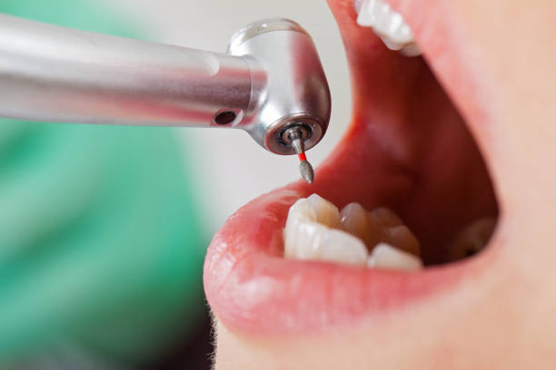 Best Chipped Tooth Repair Near Me  in Womelsdorf, PA